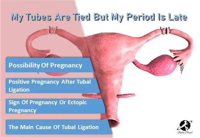 What Does It Mean When Your Period Is Late And Your Tubes Are Tied