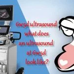 What Does an Ultrasound at 6w5d Look Like?