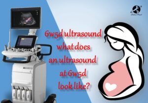 What does an ultrasound at 6w5d look like? - Babiesplannet