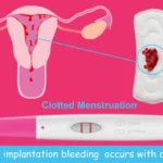 Heavy Implantation Bleeding with Clots Stories