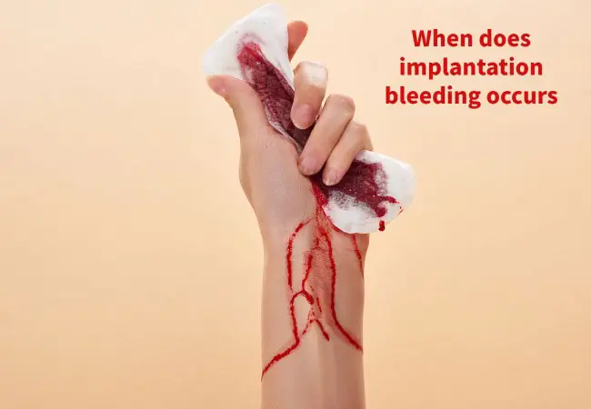 When does implantation bleeding occurs pictures