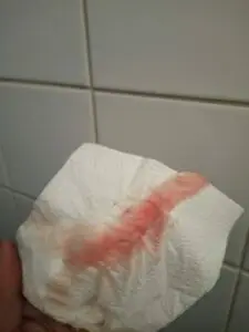 real implantation bleeding pictures of pink blood