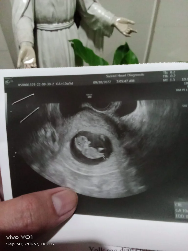 Ultrasound result at 10 weeks when T line is not showing up