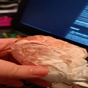 heavy implantation bleeding pictures