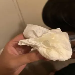 implantation bleeding pics on mucus discharge