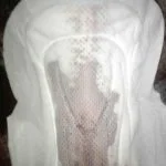 heavy implantation bleeding pictures on pads
