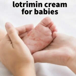 lotrimin cream for babies