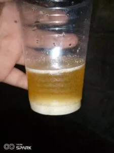 Positive urine pregnancy test result