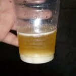 positive test with urine