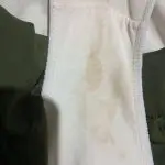 real pictures of heavy implantation bleeding