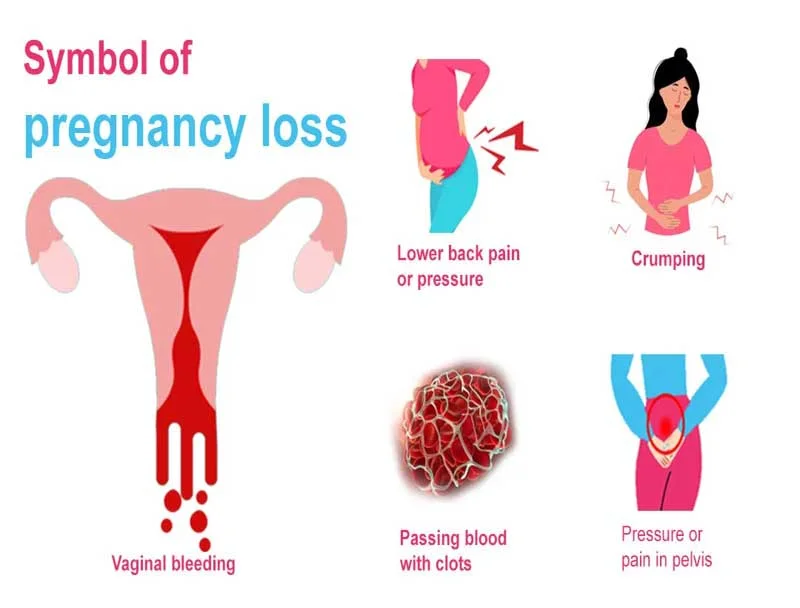 Has anyone had heavy implantation bleeding and still was pregnant