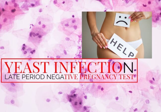 top-14-yeast-infection-late-period-negative-pregnancy-test-2023