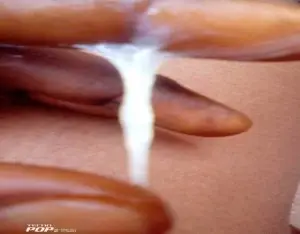 cervical mucus real picture
