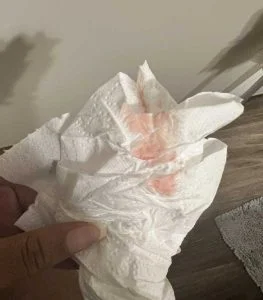 implantation bleeding color