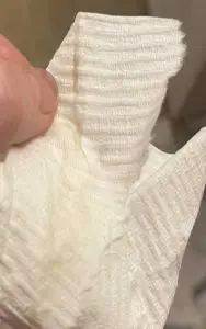 implantation white mucus discharge picture on a tissue