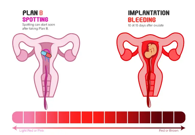 plan-b-spotting-vs-implantation-bleeding-differences