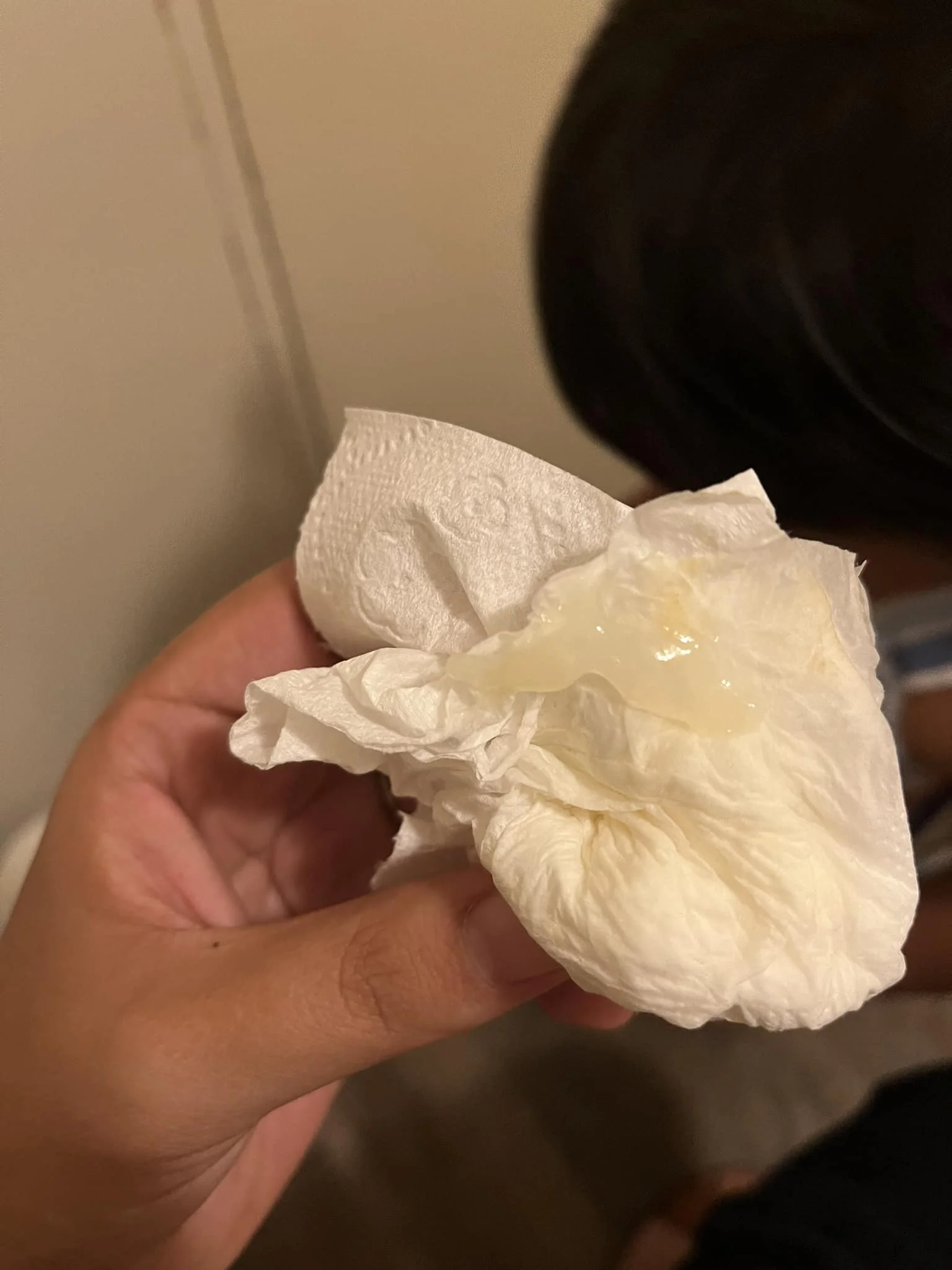 abnormal mucus discharge cause foul smelling period