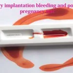 Heavy Implantation Bleeding and Positive Pregnancy Test